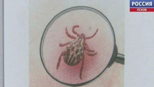 В Псковской области после укусов клещей за помощью обратились 45 человек, включая 17 детей