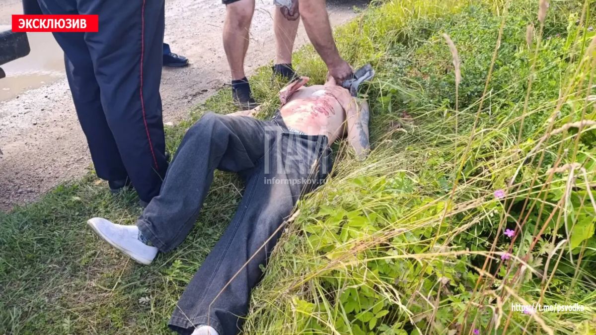 В Дно, на улице Интернациональной в доме 21, в ходе конфликта мужчина получил ножевое ранение В Дно, на улице Интернациональной в доме 21, в ходе конфликта мужчина получил ножевое ранение